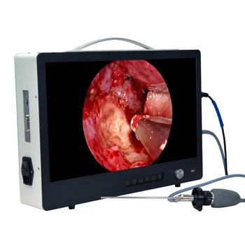 Nešiojamų endoskopinis Veterinarijos Full Hd 1080p Integruota Ent/laparoskopija/urologijos Medicininės Endoskopijos