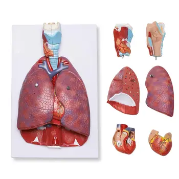 Išardyta Dėl Anatominių Žmogaus Plaučių Modelis Kvėpavimo Sistemos Anatomija Mokyklos Mokslo Ištekliai Tyrimų Ekranas Mokymo Reikmenys